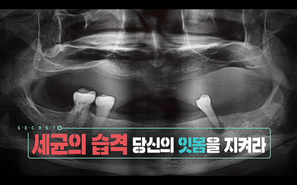 '생로병사의 비밀' 잇몸 세균으로 발생하는 치명적 질병(사진=KBS1)